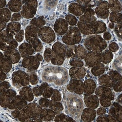 CTR2 Antibody, Novus Biologicals:Antibodies:Primary Antibodies